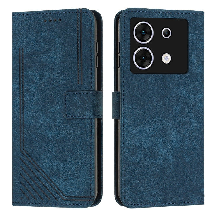 Skin Feel Stripe Pattern Leather Phone Case with Lanyard, For Infinix Smart 8, For Infinix Zero 30 4G, For Infinix Zero 30 5G, For Infinix Hot 30 Play NFC, For Infinix Note 30/Note 30 5G, For Infinix Note 30i, For Infinix Note 30 Pro                   ...