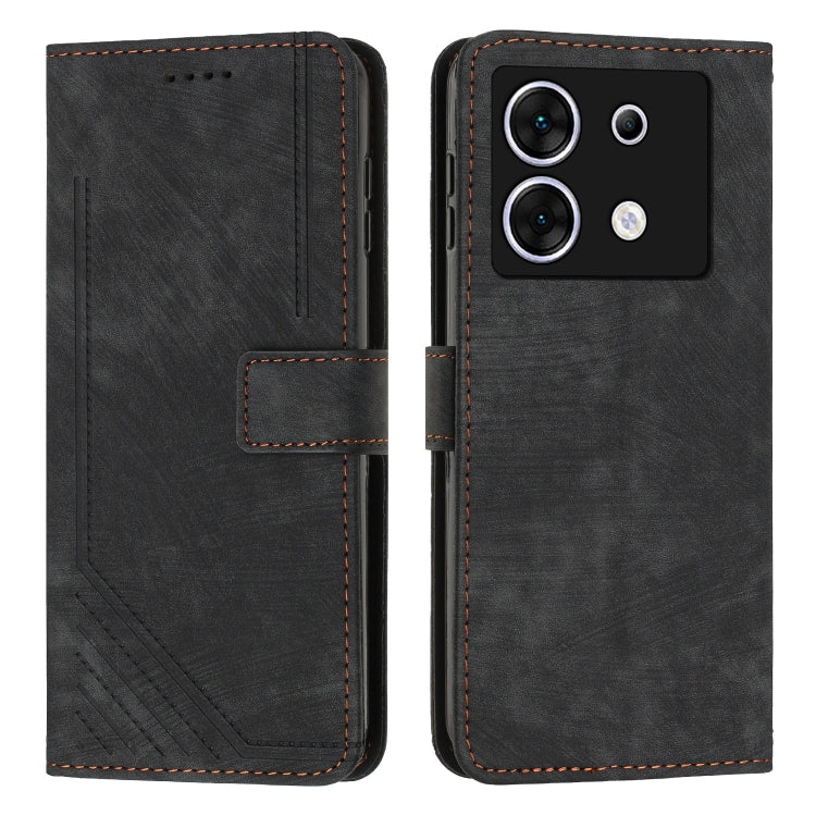 Skin Feel Stripe Pattern Leather Phone Case with Lanyard, For Infinix Smart 8, For Infinix Zero 30 4G, For Infinix Zero 30 5G, For Infinix Hot 30 Play NFC, For Infinix Note 30/Note 30 5G, For Infinix Note 30i, For Infinix Note 30 Pro                   ...