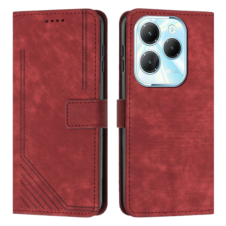Skin Feel Stripe Pattern Leather Phone Case with Lanyard, For Infinix Hot 50 Pro+ 4G, For Infinix Note 40 5G, For Infinix GT 20 Pro, For Infinix Note 40 Pro 4G / 5G, For Infinix Note 40 4G, For Infinix Hot 40 / 40 Pro, For Infinix Hot 40i              ...