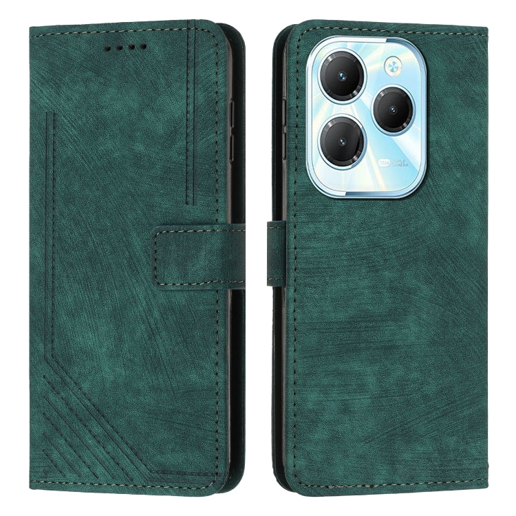 Skin Feel Stripe Pattern Leather Phone Case with Lanyard, For Infinix Hot 50 Pro+ 4G, For Infinix Note 40 5G, For Infinix GT 20 Pro, For Infinix Note 40 Pro 4G / 5G, For Infinix Note 40 4G, For Infinix Hot 40 / 40 Pro, For Infinix Hot 40i              ...