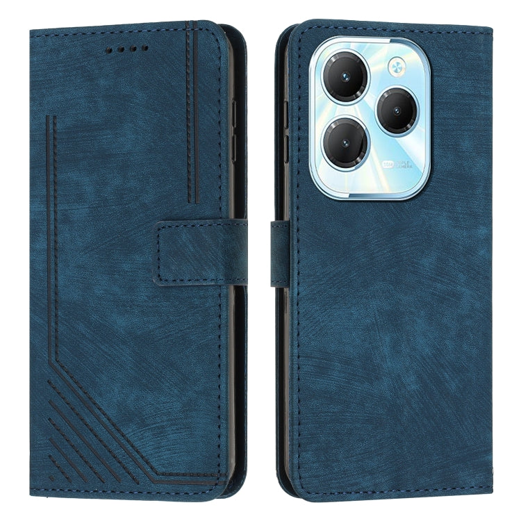 Skin Feel Stripe Pattern Leather Phone Case with Lanyard, For Infinix Hot 50 Pro+ 4G, For Infinix Note 40 5G, For Infinix GT 20 Pro, For Infinix Note 40 Pro 4G / 5G, For Infinix Note 40 4G, For Infinix Hot 40 / 40 Pro, For Infinix Hot 40i              ...