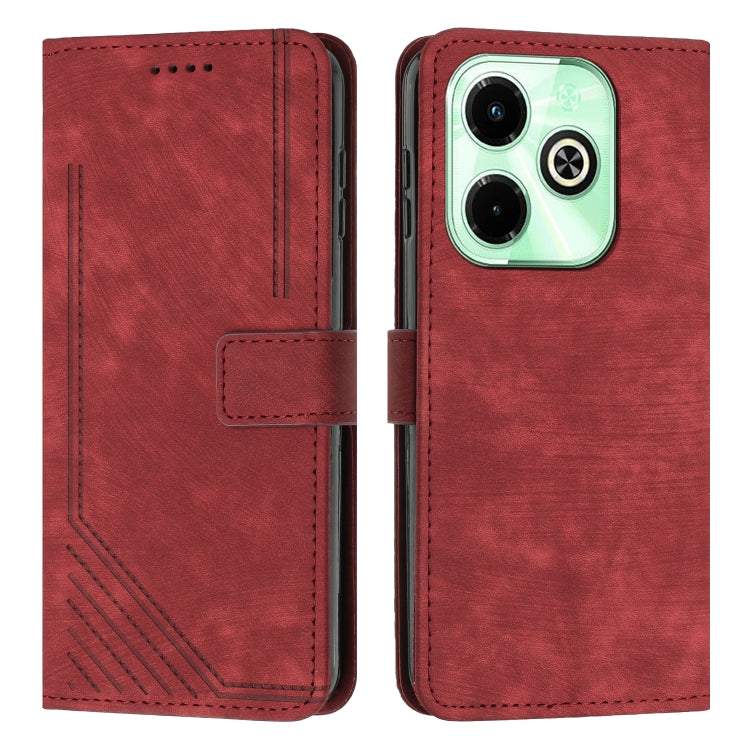 Skin Feel Stripe Pattern Leather Phone Case with Lanyard, For Infinix Hot 50 Pro+ 4G, For Infinix Note 40 5G, For Infinix GT 20 Pro, For Infinix Note 40 Pro 4G / 5G, For Infinix Note 40 4G, For Infinix Hot 40 / 40 Pro, For Infinix Hot 40i              ...
