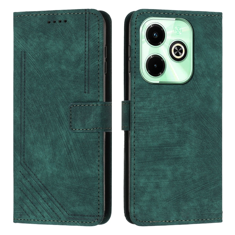 Skin Feel Stripe Pattern Leather Phone Case with Lanyard, For Infinix Hot 50 Pro+ 4G, For Infinix Note 40 5G, For Infinix GT 20 Pro, For Infinix Note 40 Pro 4G / 5G, For Infinix Note 40 4G, For Infinix Hot 40 / 40 Pro, For Infinix Hot 40i              ...