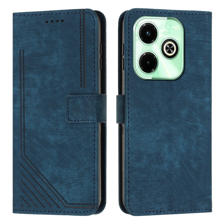 Skin Feel Stripe Pattern Leather Phone Case with Lanyard, For Infinix Hot 50 Pro+ 4G, For Infinix Note 40 5G, For Infinix GT 20 Pro, For Infinix Note 40 Pro 4G / 5G, For Infinix Note 40 4G, For Infinix Hot 40 / 40 Pro, For Infinix Hot 40i              ...