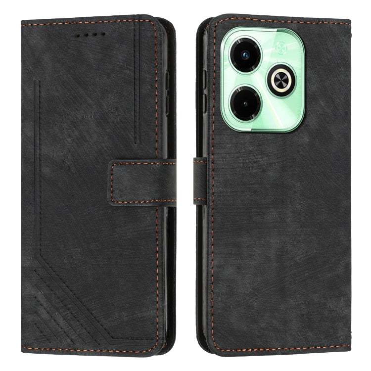 Skin Feel Stripe Pattern Leather Phone Case with Lanyard, For Infinix Hot 50 Pro+ 4G, For Infinix Note 40 5G, For Infinix GT 20 Pro, For Infinix Note 40 Pro 4G / 5G, For Infinix Note 40 4G, For Infinix Hot 40 / 40 Pro, For Infinix Hot 40i              ...