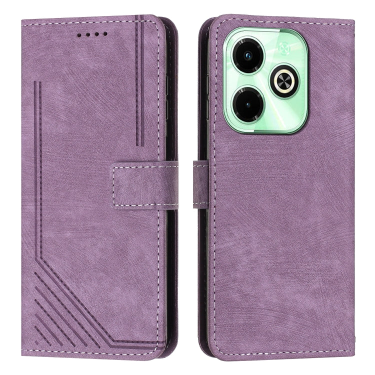 Skin Feel Stripe Pattern Leather Phone Case with Lanyard, For Infinix Hot 50 Pro+ 4G, For Infinix Note 40 5G, For Infinix GT 20 Pro, For Infinix Note 40 Pro 4G / 5G, For Infinix Note 40 4G, For Infinix Hot 40 / 40 Pro, For Infinix Hot 40i              ...