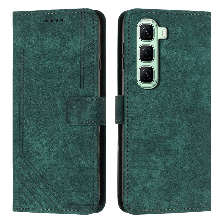 Skin Feel Stripe Pattern Leather Phone Case with Lanyard, For Infinix Smart 10 4G, For Infinix GT 30 Pro, For Infinix Note 50s, For Infinix Note 50x, For Infinix Note 50 Pro+, For Infinix Note 50 4G / 50 Pro 4G, For Infinix Hot 50 Pro 4G               ...