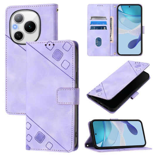 Skin-feel Embossed Leather Phone Case, For Honor Power 5G, For Honor Play 60 5G, For Honor 400 Lite Global, For Honor 400 Global 156.5mm, For Honor X8c 4G Global, For Honor GT, For Honor X9c Smart 5G Global, For Honor 300 Pro 5G / 300 Ultra