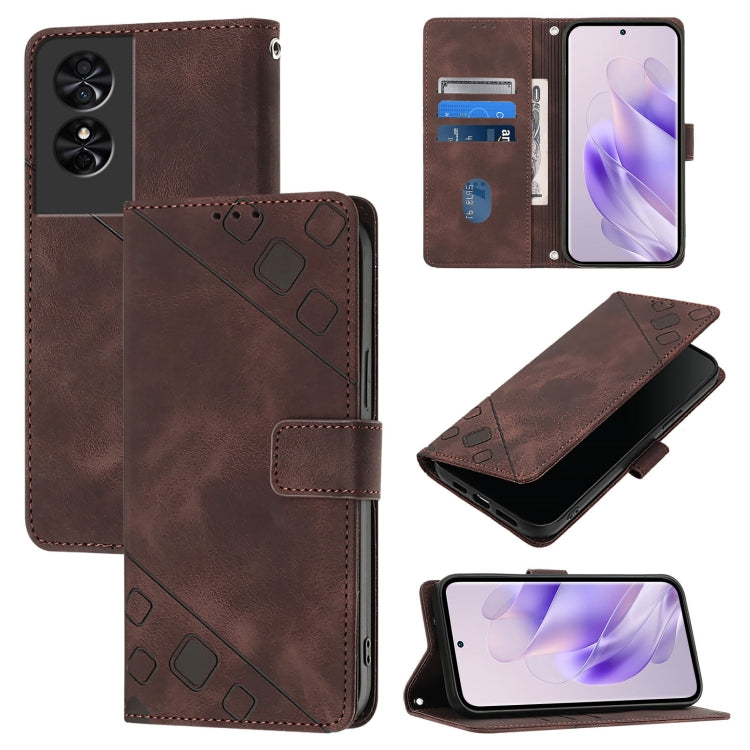 Skin Feel Embossed Leather Phone Case, For TCL 50 5G, For TCL 50 SE, For TCL 501, For TCL 505, For TCL 502, For TCL 405 / 406 / 408, For TCL 40 XL / 40 T T608DL, For TCL 40 SE