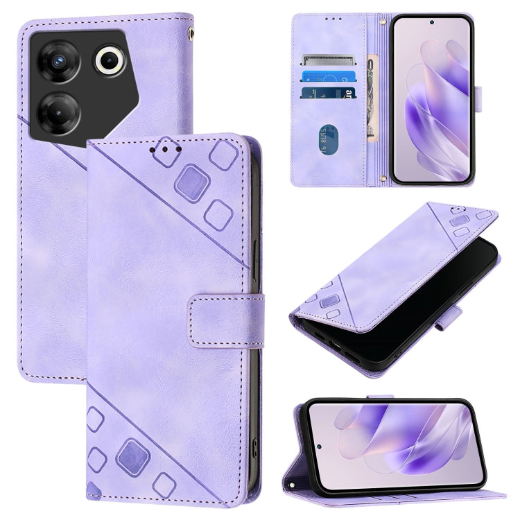 Skin Feel Embossed Leather Phone Case, For Tecno Camon 20 Pro 5G, For Tecno Camon 20 / 20 Pro 4G, For Tecno Spark Go 2023 / Pop 7 / Pop 7 Pro, For Tecno Spark 10C, For Tecno Spark 10 4G, For Tecno Pova Neo 2, For Tecno Spark 9, For Tecno Pop 5c