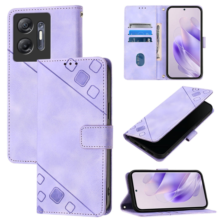 Skin Feel Embossed Leather Phone Case, For Infinix Hot 40 / Hot 40 Pro, For Infinix Hot 40i, For Infinix Smart 8, For Infinix Zero 30 4G, For Infinix Zero 30 5G, For Infinix Hot 30 5G, For Infinix Hot 30 Play / Hot 30 Play NFC                          ...