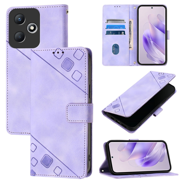 Skin Feel Embossed Leather Phone Case, For Infinix Hot 40 / Hot 40 Pro, For Infinix Hot 40i, For Infinix Smart 8, For Infinix Zero 30 4G, For Infinix Zero 30 5G, For Infinix Hot 30 5G, For Infinix Hot 30 Play / Hot 30 Play NFC                          ...