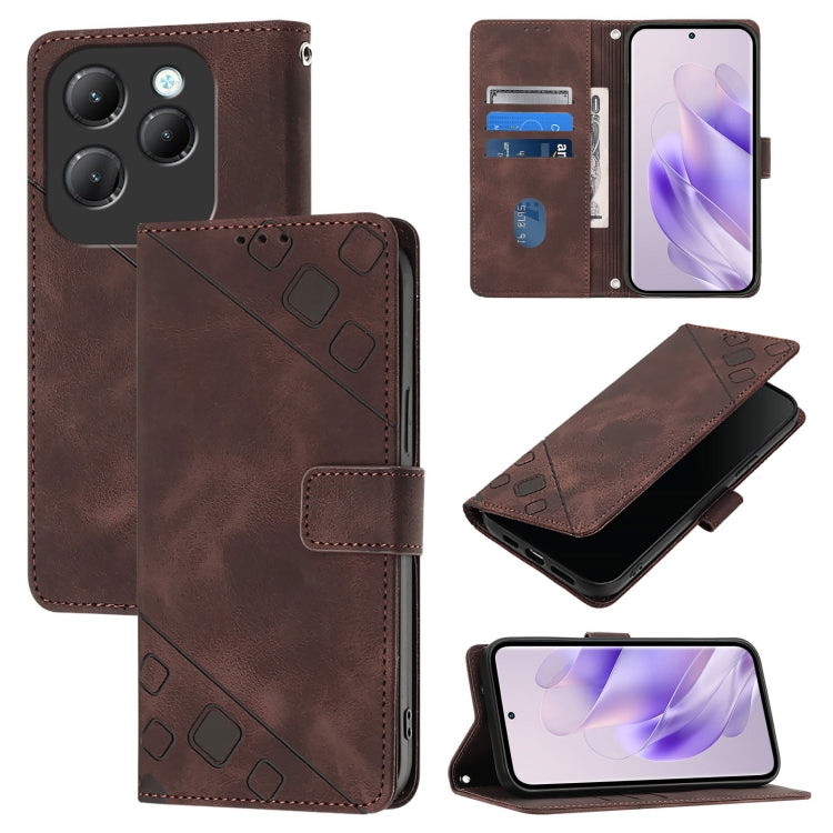 Skin Feel Embossed Leather Phone Case, For Infinix Hot 40 / Hot 40 Pro, For Infinix Hot 40i, For Infinix Smart 8, For Infinix Zero 30 4G, For Infinix Zero 30 5G, For Infinix Hot 30 5G, For Infinix Hot 30 Play / Hot 30 Play NFC                          ...