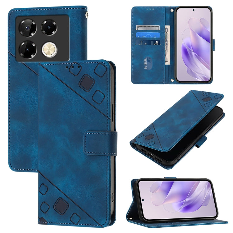 Skin Feel Embossed Leather Phone Case, For Infinix Note 50s, For Infinix Hot 50 Pro+ 4G, For Infinix Smart 8 Plus / Smart 8 Pro, For Infinix GT 20 Pro X6871, For Infinix Note 40 Pro 4G, For Infinix Note 40 Pro 5G, For Infinix Note 40                   ...