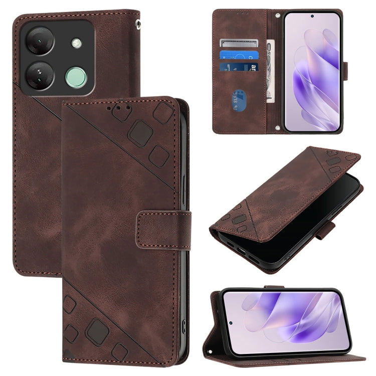 Skin Feel Embossed Leather Phone Case, For Infinix Hot 40 / Hot 40 Pro, For Infinix Hot 40i, For Infinix Smart 8, For Infinix Zero 30 4G, For Infinix Zero 30 5G, For Infinix Hot 30 5G, For Infinix Hot 30 Play / Hot 30 Play NFC                          ...