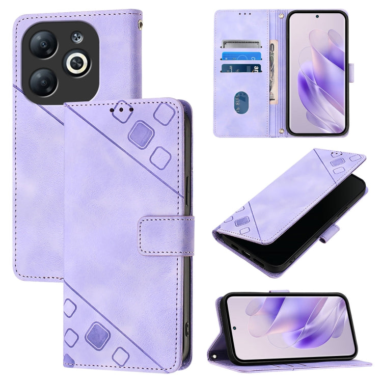 Skin Feel Embossed Leather Phone Case, For Infinix Hot 40 / Hot 40 Pro, For Infinix Hot 40i, For Infinix Smart 8, For Infinix Zero 30 4G, For Infinix Zero 30 5G, For Infinix Hot 30 5G, For Infinix Hot 30 Play / Hot 30 Play NFC                          ...