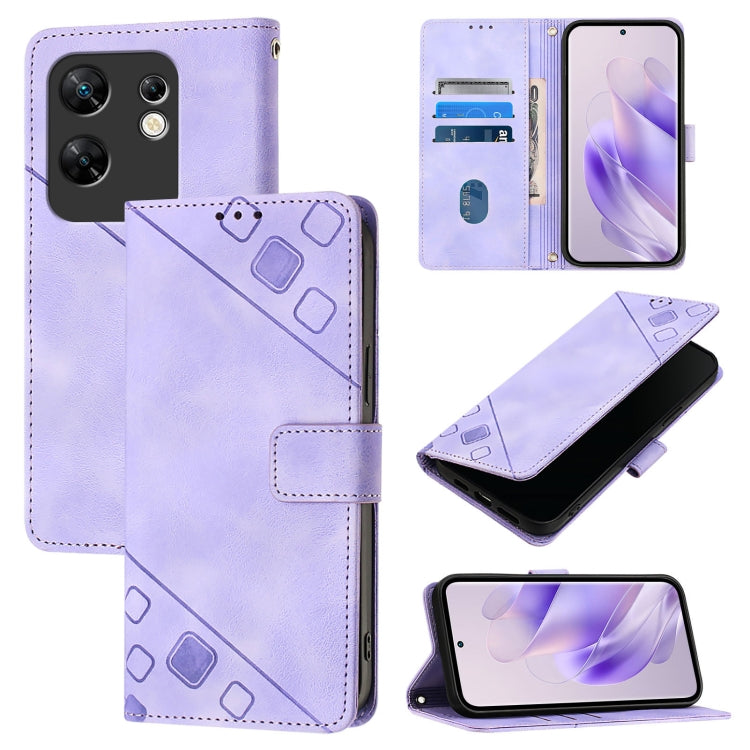 Skin Feel Embossed Leather Phone Case, For Infinix Hot 40 / Hot 40 Pro, For Infinix Hot 40i, For Infinix Smart 8, For Infinix Zero 30 4G, For Infinix Zero 30 5G, For Infinix Hot 30 5G, For Infinix Hot 30 Play / Hot 30 Play NFC                          ...