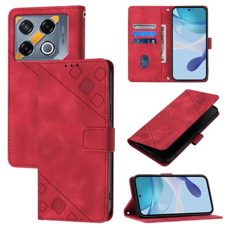 Skin Feel Embossed Leather Phone Case, For Infinix Note 50s, For Infinix Hot 50 Pro+ 4G, For Infinix Smart 8 Plus / Smart 8 Pro, For Infinix GT 20 Pro X6871, For Infinix Note 40 Pro 4G, For Infinix Note 40 Pro 5G, For Infinix Note 40                   ...