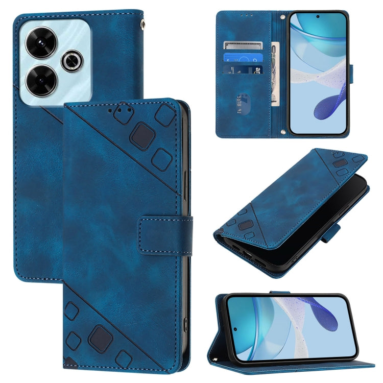 Skin-feel Embossed Leather Phone Case, For Redmi K70 Ultra 5G Global, For Redmi 13 4G