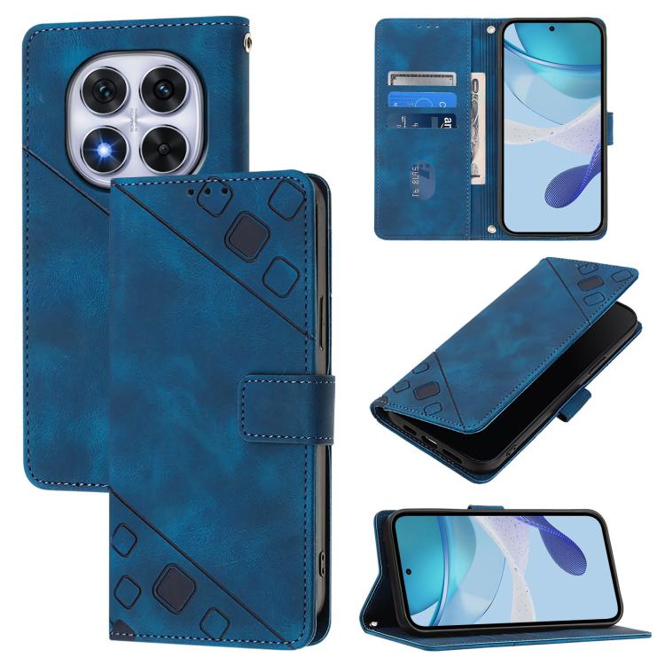 Skin-feel Embossed Leather Phone Case, For Redmi 15 5G Global / 15 4G SEA, For Redmi 15 5G / 4G EU 171mm, For Redmi Note 14 4G 164.84mm, For Redmi K80 5G / K80 Pro 5G, For Redmi Note 14 Pro 4G, For Redmi Note 14 4G 163.25mm, For Redmi Note 14 5G Global...