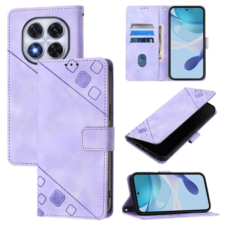 Skin-feel Embossed Leather Phone Case, For Redmi 15 5G Global / 15 4G SEA, For Redmi 15 5G / 4G EU 171mm, For Redmi Note 14 4G 164.84mm, For Redmi K80 5G / K80 Pro 5G, For Redmi Note 14 Pro 4G, For Redmi Note 14 4G 163.25mm, For Redmi Note 14 5G Global...