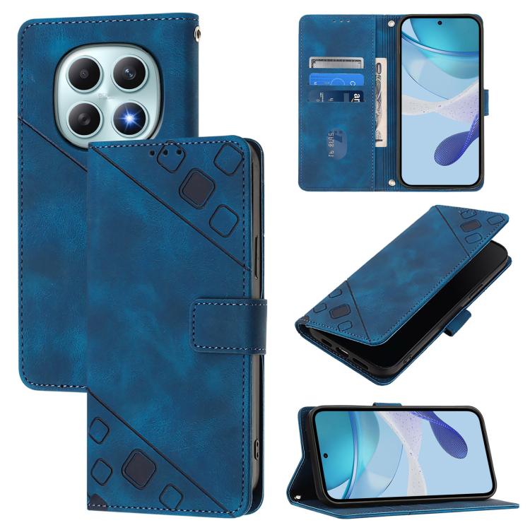 Skin-feel Embossed Leather Phone Case, For Redmi K90 Max 5G, For Redmi A7 Pro 5G 171mm / Poco C81, For Redmi 15a 5G Global, For Redmi A5 4G 171.7mm / Poco C71 4G, For Redmi Turbo 5 5G Global / Poco X8 Pro, For Redmi Note 15 Pro+ 5G Global 163.3mm      ...