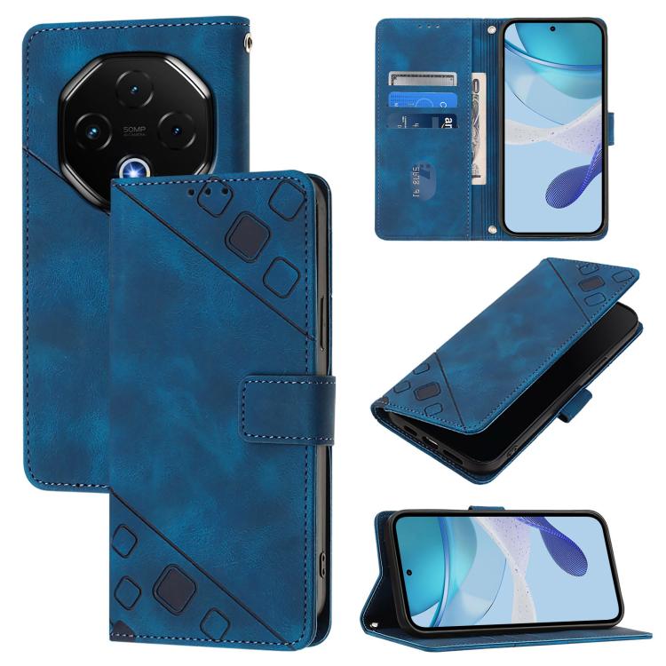 Skin-feel Embossed Leather Phone Case, For Umidigi G100X 4G / 5G, For Umidigi G100 Pro, For UMIDIGI Note 100, For Umidigi Bison X20, For Umidigi A15 / A15C / A15T, For UMIDIGI Power 7 / Power 7S, For UMIDIGI Power 7 Max