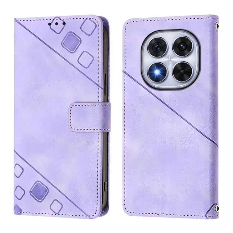 Skin-feel Embossed Leather Phone Case, For Xiaomi Poco X7 5G, For Xiaomi 15 Ultra, For Xiaomi Poco X7 Pro 5G, For Xiaomi Poco M7 Pro 5G Global, For Xiaomi 14T Pro, For Xiaomi 14T